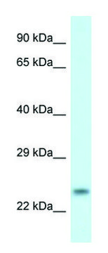 Anti-RND1 (C-terminal) antibody produced in rabbit affinity isolated antibody