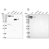 Anti-PLCB3 antibody produced in rabbit Prestige Antibodies® Powered by Atlas Antibodies, affinity isolated antibody, buffered aqueous glycerol solution