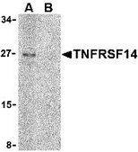 Anti-TNFRSF14 antibody produced in rabbit affinity isolated antibody