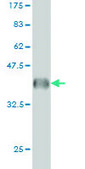 Monoclonal Anti-GLS antibody produced in mouse clone 5C4, purified immunoglobulin, buffered aqueous solution