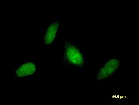 Anti-RNF114 antibody produced in mouse purified immunoglobulin, buffered aqueous solution