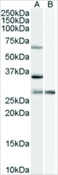 Anti-PRPF31 antibody produced in goat affinity isolated antibody, buffered aqueous solution