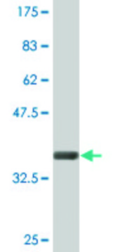 Monoclonal Anti-CLCN7, (C-terminal) antibody produced in mouse clone 4A3, ascites fluid