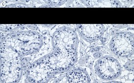 Anti-SCP-3 Antibody, clone 3M19 ZooMAb® Rabbit Monoclonal recombinant, expressed in HEK 293 cells
