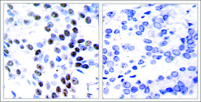 Anti-JUN (Ab-93) antibody produced in rabbit affinity isolated antibody