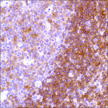 Anti-HLA-DP beta 1 antibody, Rabbit monoclonal clone SP229, recombinant, expressed in proprietary host, affinity isolated antibody