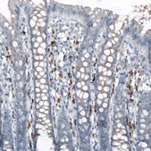 Anti-APOBEC3A antibody produced in rabbit Prestige Antibodies® Powered by Atlas Antibodies, affinity isolated antibody, buffered aqueous glycerol solution