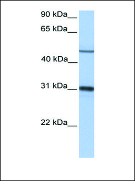 Anti-EPHX1 antibody produced in rabbit affinity isolated antibody