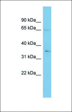 Anti-YTHDF1 antibody produced in rabbit affinity isolated antibody