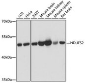 Anti-NDUFS2 antibody produced in rabbit