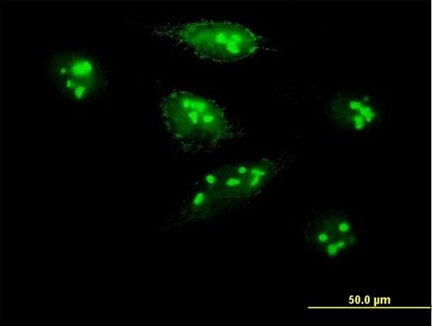 Anti-MKI67IP antibody produced in mouse purified immunoglobulin, buffered aqueous solution