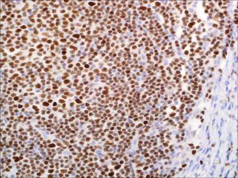 LEF1 (EP310) Rabbit Monoclonal Primary Antibody