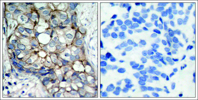 抗-EGFR (Ab-1070) 兔抗 affinity isolated antibody