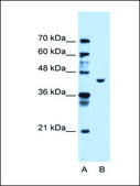 Anti-PGK1 antibody produced in rabbit IgG fraction of antiserum