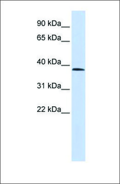 Anti-SUV420H1 (ab2) antibody produced in rabbit affinity isolated antibody