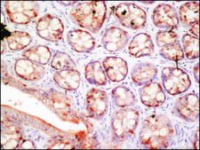 Anti-FUS (internal) antibody produced in rabbit ~1.0 mg/mL, affinity isolated antibody