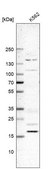 Anti-DCTN5 antibody produced in rabbit Prestige Antibodies® Powered by Atlas Antibodies, affinity isolated antibody, buffered aqueous glycerol solution