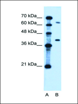 Anti-LRRC26 antibody produced in rabbit affinity isolated antibody