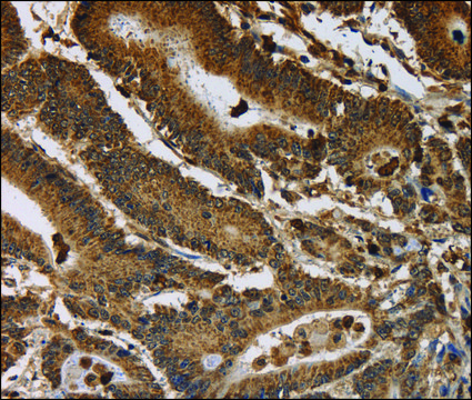 Anti-ITPR3 antibody produced in rabbit affinity isolated antibody