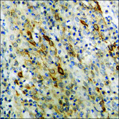 Anti-phospho-GR (pSer203) antibody produced in rabbit affinity isolated antibody