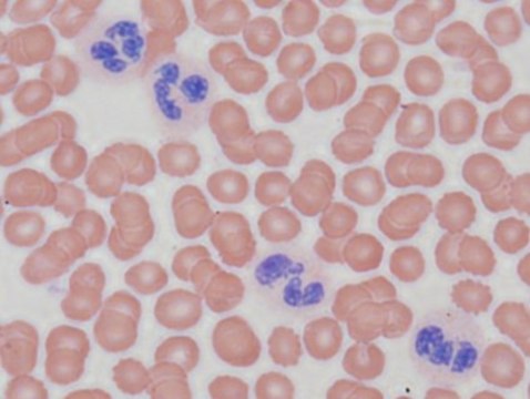 Giemsa Stain Polychromatic stain used primarily to stain blood cells and bone marrow specimens