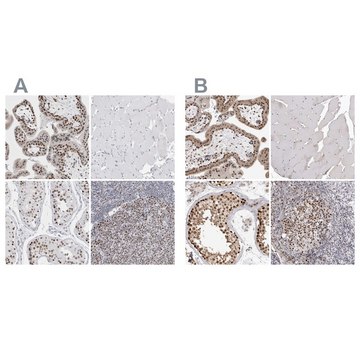 Anti-SMARCC1 antibody produced in rabbit Prestige Antibodies&#174; Powered by Atlas Antibodies, affinity isolated antibody, buffered aqueous glycerol solution