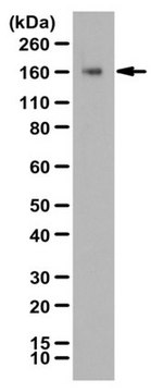 Anti-phospho Angiomotin Antibody (Ser175) from rabbit