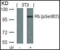 Anti-phospho-RB1 (pSer807) antibody produced in rabbit affinity isolated antibody
