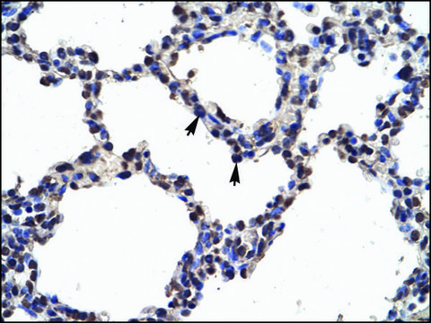 Anti-NFKB2 (AB2) antibody produced in rabbit affinity isolated antibody