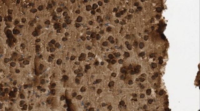 Anti-Beta-glucosidase 2 (GBA2) Antibody, clone 4A12 clone 4A12, from rat