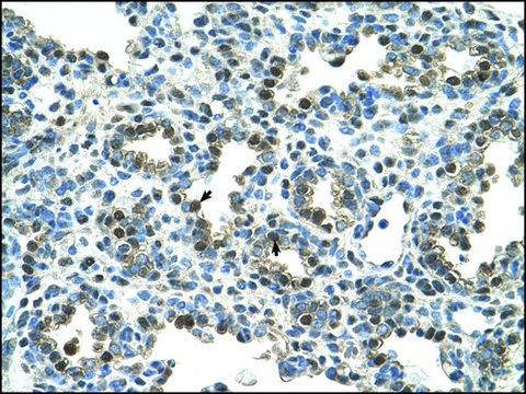 Anti-GPNMB affinity isolated antibody