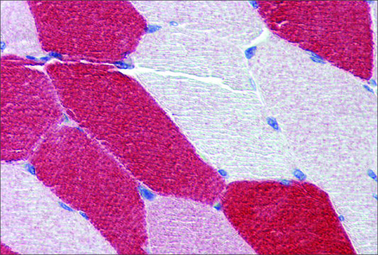 Anti-MYL6 (ab2) antibody produced in rabbit affinity isolated antibody