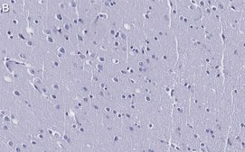 Anti-eIF-4E Antibody, clone 1K7 ZooMAb® Rabbit Monoclonal recombinant, expressed in HEK 293 cells
