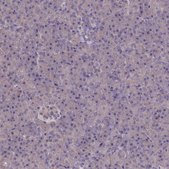 Anti-ATF7IP2 antibody produced in rabbit Prestige Antibodies® Powered by Atlas Antibodies, affinity isolated antibody, buffered aqueous glycerol solution