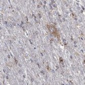 Anti-SCCPDH antibody produced in rabbit Prestige Antibodies® Powered by Atlas Antibodies, affinity isolated antibody, buffered aqueous glycerol solution