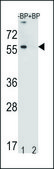ANTI-TOX3 (CENTER) antibody produced in rabbit IgG fraction of antiserum, buffered aqueous solution