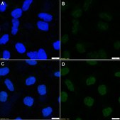 Anti-Topo I-DNA Complex clone 1.1A ZooMAb® Mouse Monoclonal recombinant, expressed in HEK 293 cells