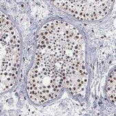 Anti-TRMT5 antibody produced in rabbit Prestige Antibodies® Powered by Atlas Antibodies, affinity isolated antibody, buffered aqueous glycerol solution