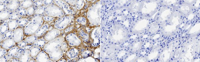 Anti-Collagen &#945;-4 Antibody, clone 1F3 ZooMAb&#174; Rabbit Monoclonal recombinant, expressed in HEK 293 cells