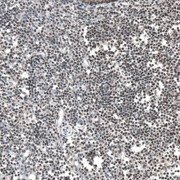 Anti-JADE2 antibody produced in rabbit Prestige Antibodies® Powered by Atlas Antibodies, affinity isolated antibody, buffered aqueous glycerol solution