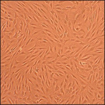 Human Chondrocytes - Rheumatoid Arthritis: HC-RA, adult