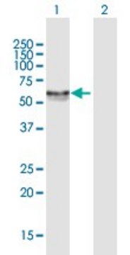 Anti-CA9 antibody produced in mouse purified immunoglobulin, buffered aqueous solution