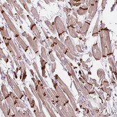 Anti-CTNNA3 antibody produced in rabbit Prestige Antibodies® Powered by Atlas Antibodies, affinity isolated antibody, buffered aqueous glycerol solution