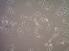 sLT-RMS Spontaneous Lung-tropic RET Melanoma-sorted Mouse Cell Line
