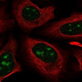 Anti-NOVA1 antibody produced in rabbit Prestige Antibodies® Powered by Atlas Antibodies, affinity isolated antibody, buffered aqueous glycerol solution