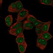 Anti-HOXD9 antibody produced in rabbit Prestige Antibodies® Powered by Atlas Antibodies, affinity isolated antibody