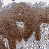 Anti-RIOK3 antibody produced in rabbit Prestige Antibodies® Powered by Atlas Antibodies, affinity isolated antibody, buffered aqueous glycerol solution