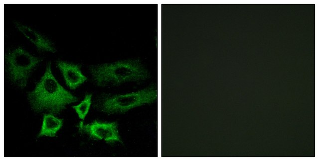 Anti-NT5C1A antibody produced in rabbit affinity isolated antibody