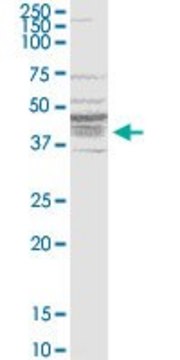 Monoclonal Anti-BDKRB1 antibody produced in mouse clone 3A2, purified immunoglobulin, buffered aqueous solution