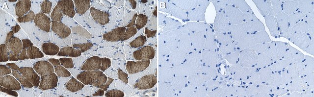 Anti-ATP2A2/SERCA2 Antibody, clone 1G13 ZooMAb&#174; Rabbit Monoclonal recombinant, expressed in HEK 293 cells